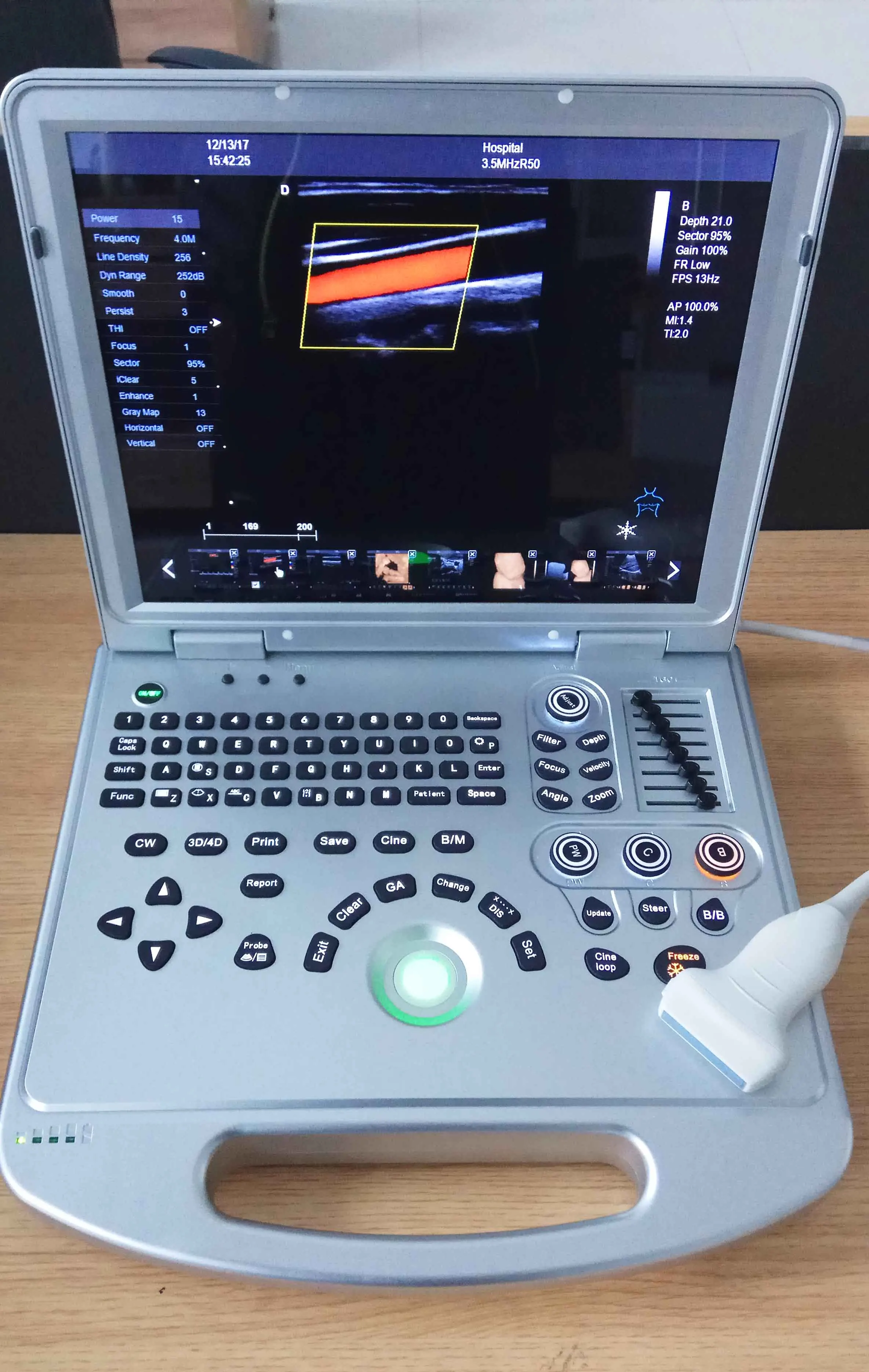 LTUB11V portable 3D/4D ultrasound machine laptop color doppler veterinary ultrasound scanner
