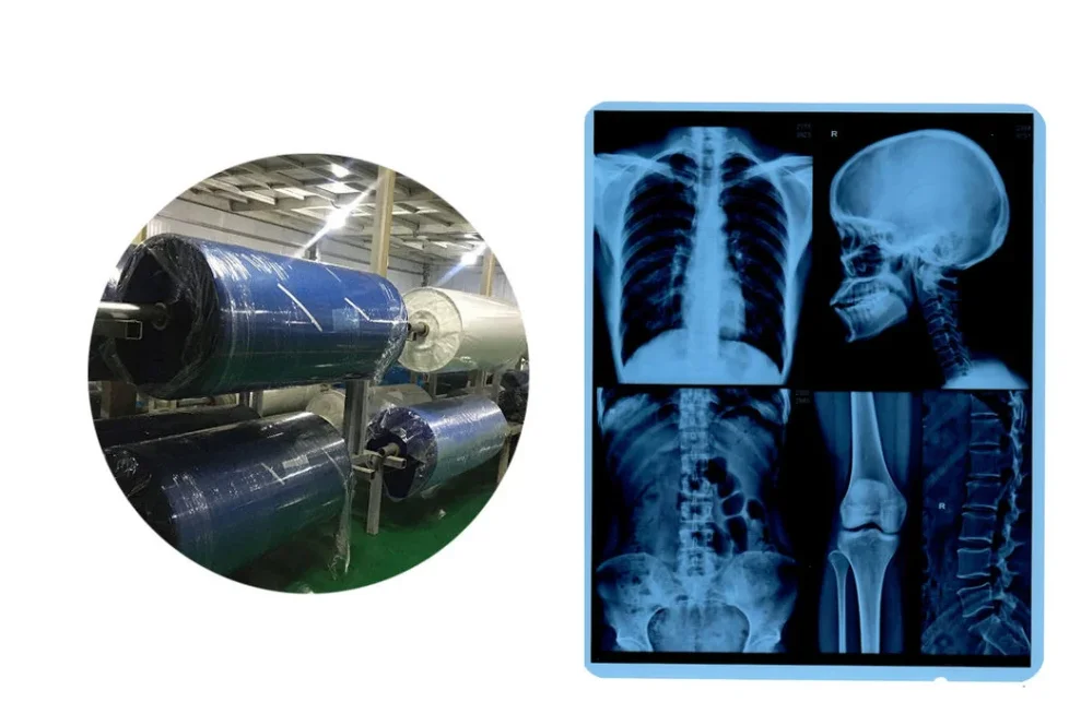 125 Micron Semi Transparent White Color Semi Transparent Laser Medical X-ray Plastic Pet Films For Medical Used