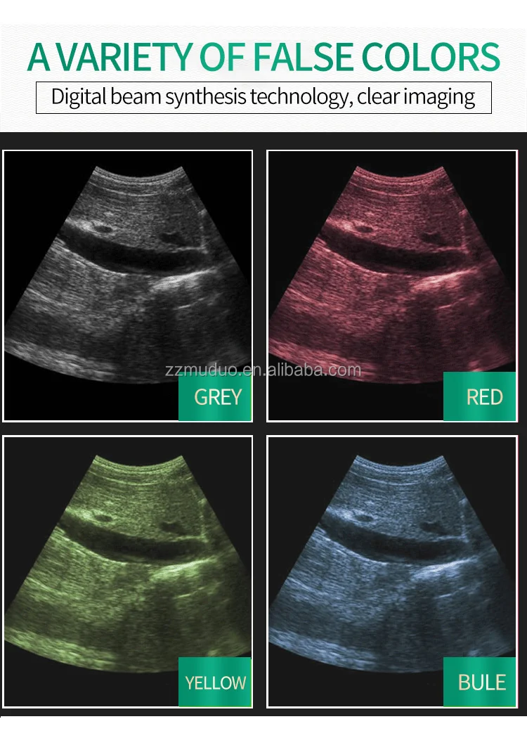 pregnant test (3)