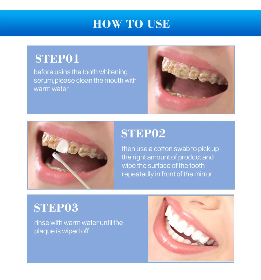 Teeth Whitening (6).jpg