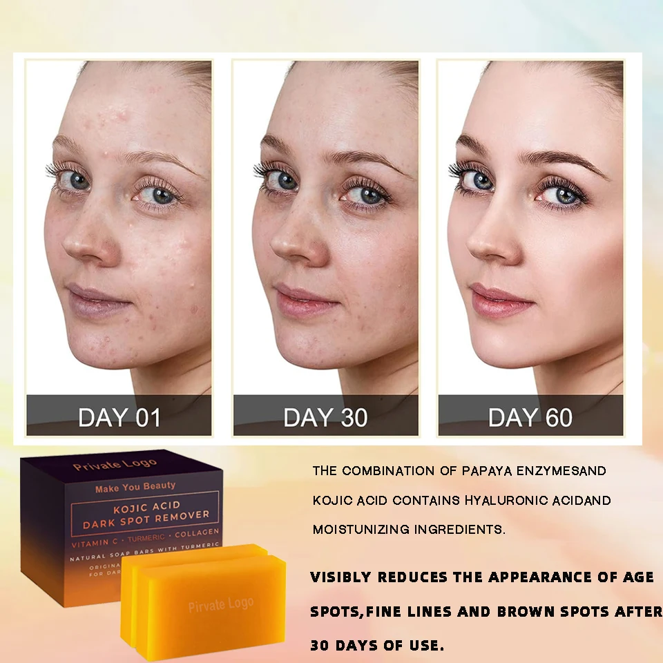 kojic acid soap