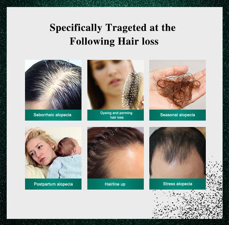 agerios hair loss 2