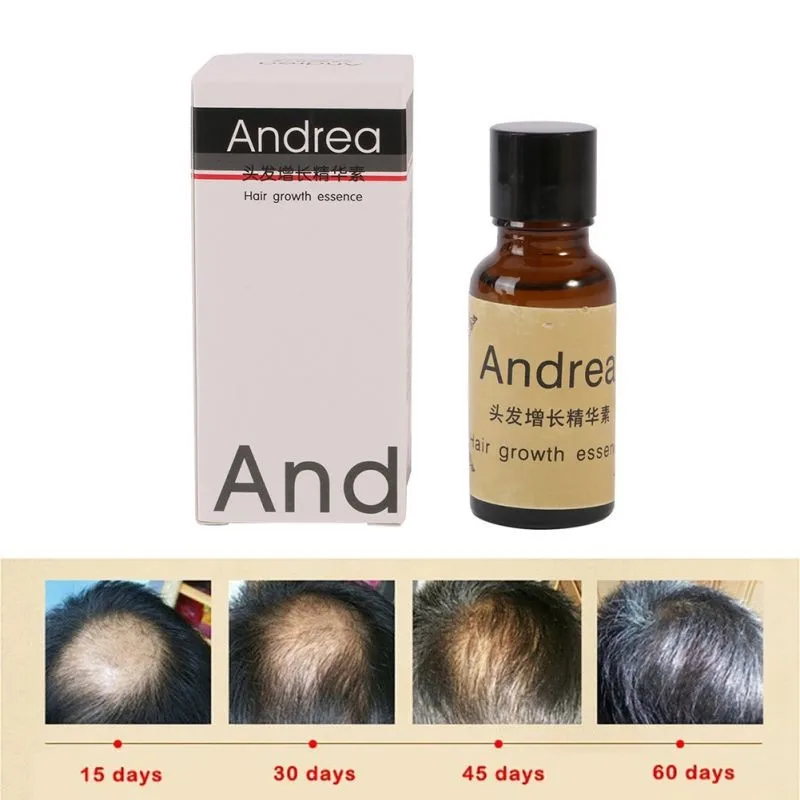 
Лидер продаж 2018 г., сыворотка для роста волос Andrea, масло для мужчин и женщин 