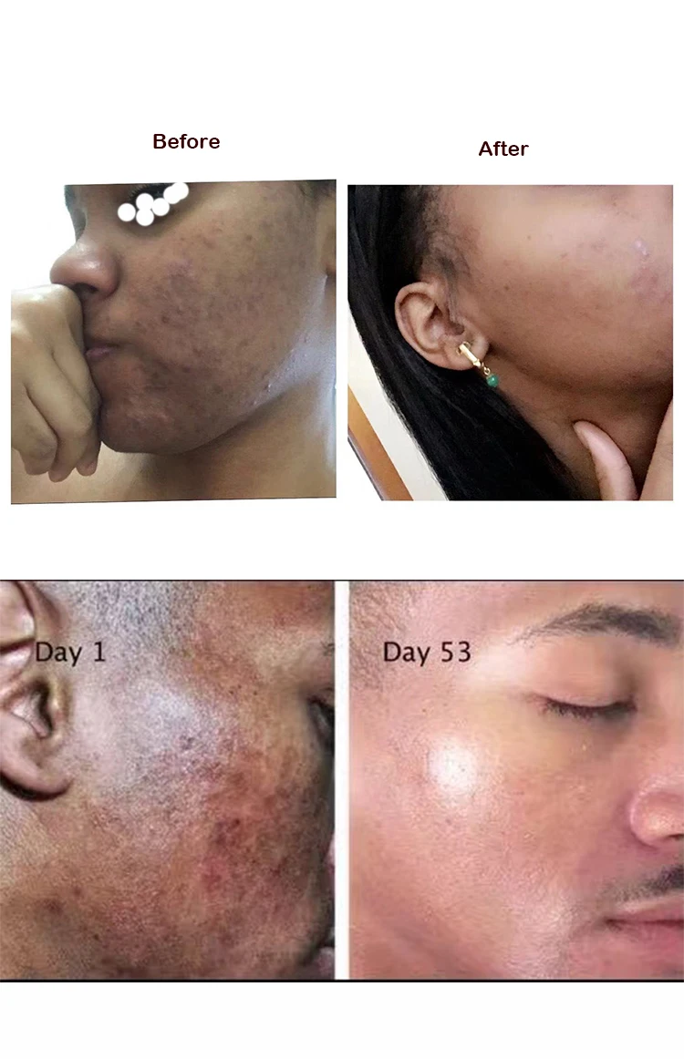 before and after