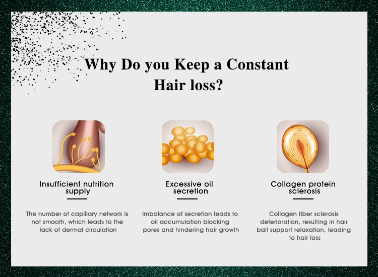 agerios hair loss 1