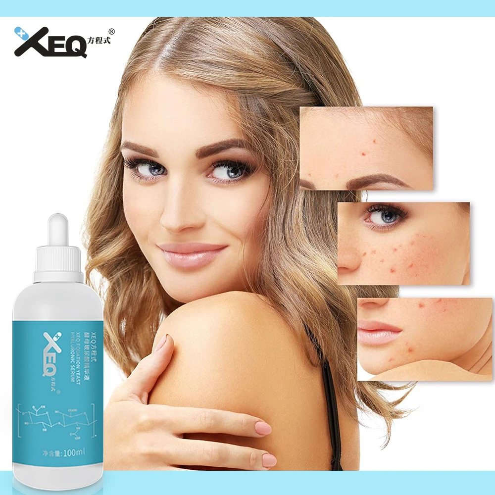 
 XEQ, гиалуроновая кислота, антивозрастной, укрепляющий кожу, гиалуроновая кислота для кожи, коллаген, гиалуроновая кислота  