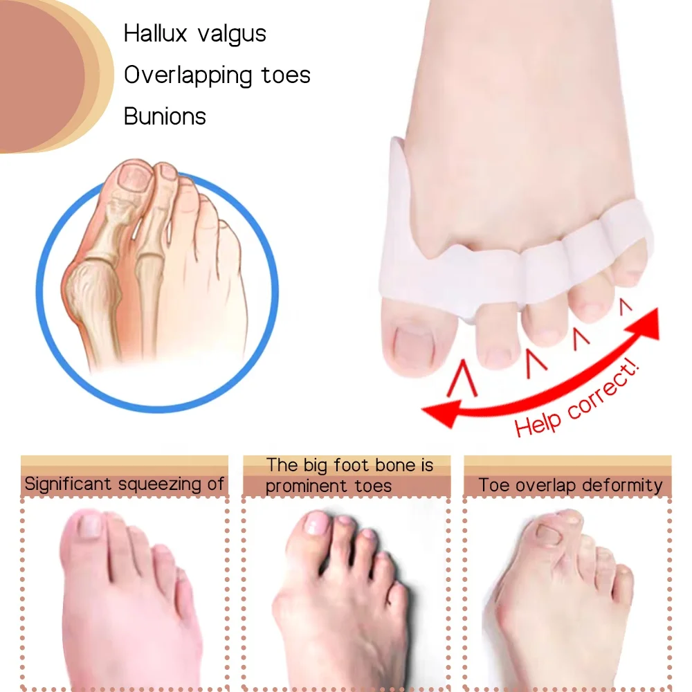 Растяжитель пальцев ног с 5 отверстиями и разделители пальцев ног, расширители пальцев ног из мягкого силикона для облегчения боли при бурсите