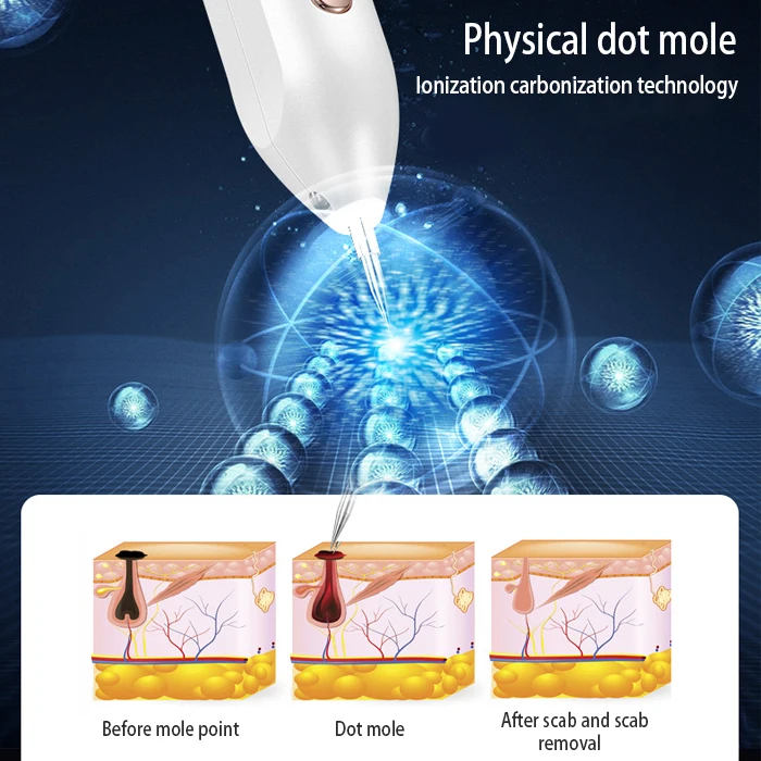 Девятью скоростями Светодиодная лампа удаление пятен Кротов красота кожа плазменная ручка для удаления веснушек и татуировок для домашнего использования