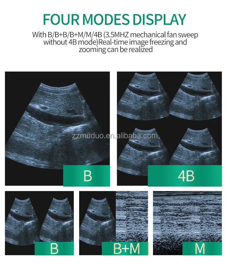pregnant test (4)