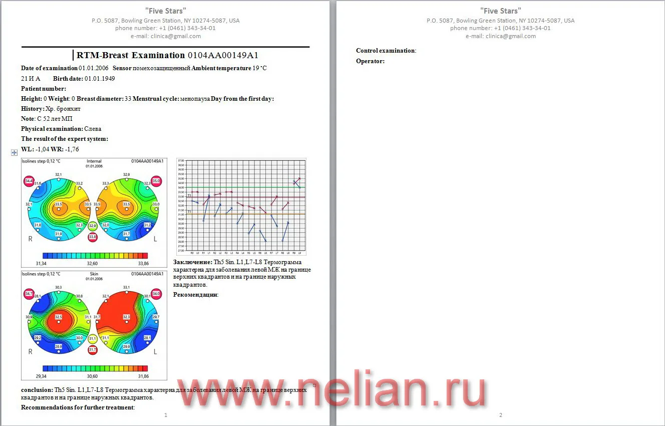 RTM-D2M-sw-08.JPG