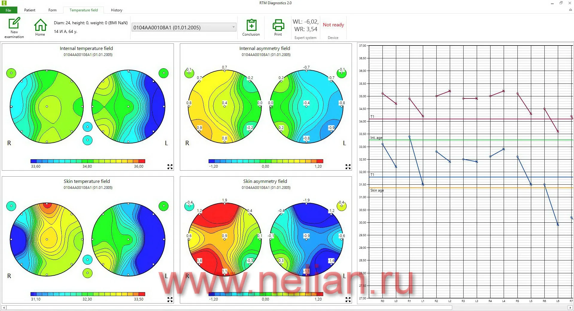 RTM-D2M-sw-01.JPG