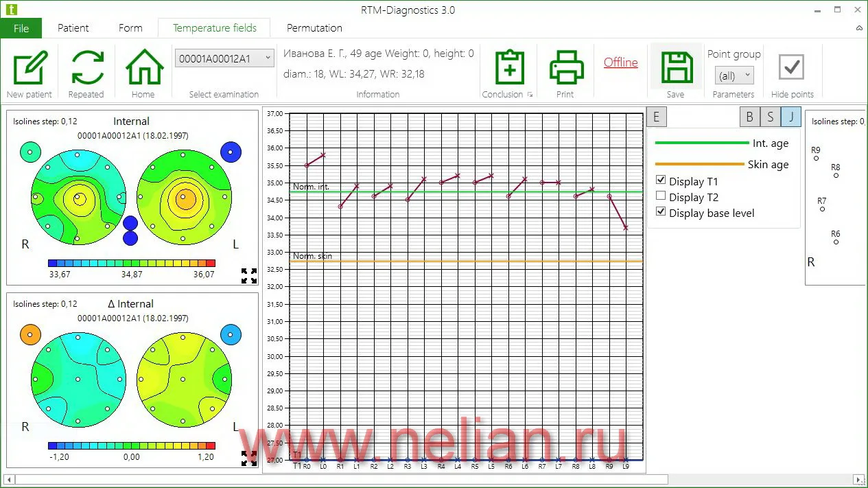 RTM-D2M-sw-03.JPG
