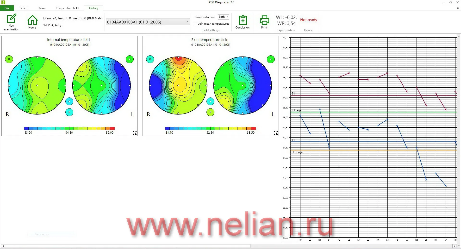 RTM-D2M-sw-05.JPG