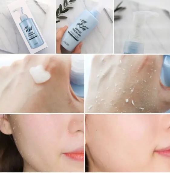 [Korea Cosmetics]All kill refresh peeling gel hypoallergenic exfoliate face peeling gel Moisture retention and brightening