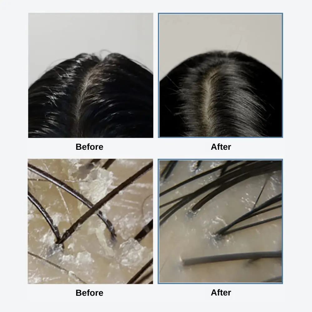 Private Label Custom Natural Hair Care 2-in-1 Shampoo and Scalp Scrub with Sea Salt and Sea Water Scalp Scrub Shampoo