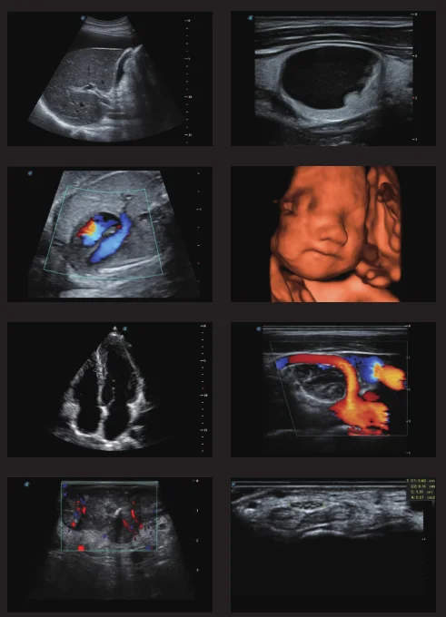 Trolley Color Doppler ultrasound scanner 3D/4D sonoscape P25 machine with a good price.