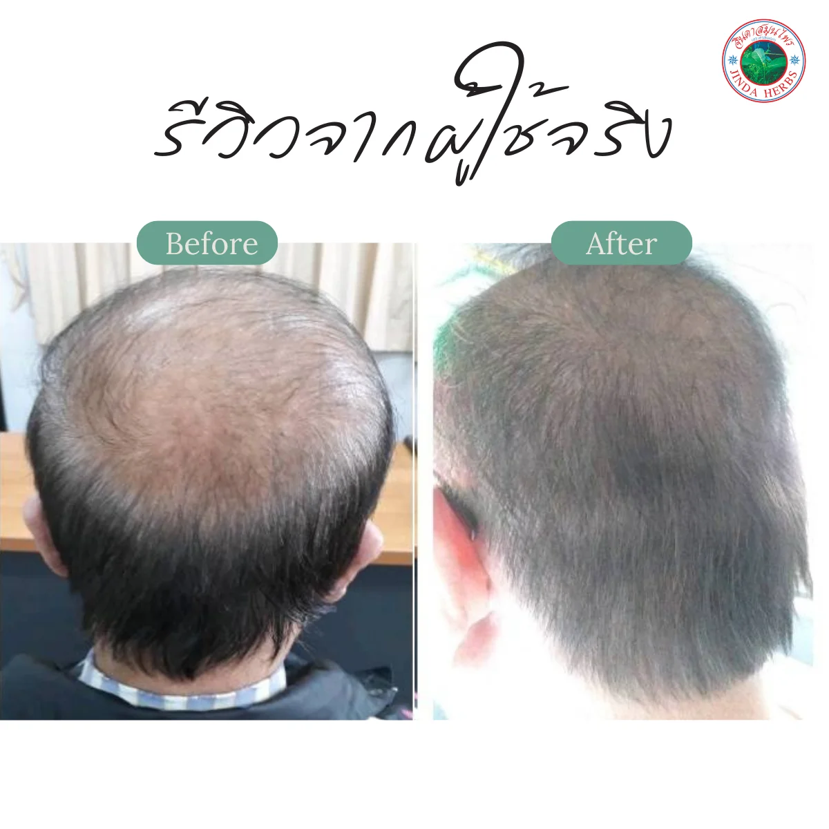 JINDA 250ml Herbal Shampoo Infused with Anthocyanin Stronger Hair Mee Leaves Butterfly Pea Natural Hair Loss Prevention