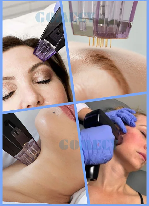 rf-micronee-fractional-beauty-machine-golden-micro-needle-3-in-1-skin-tightening-morpheus-8