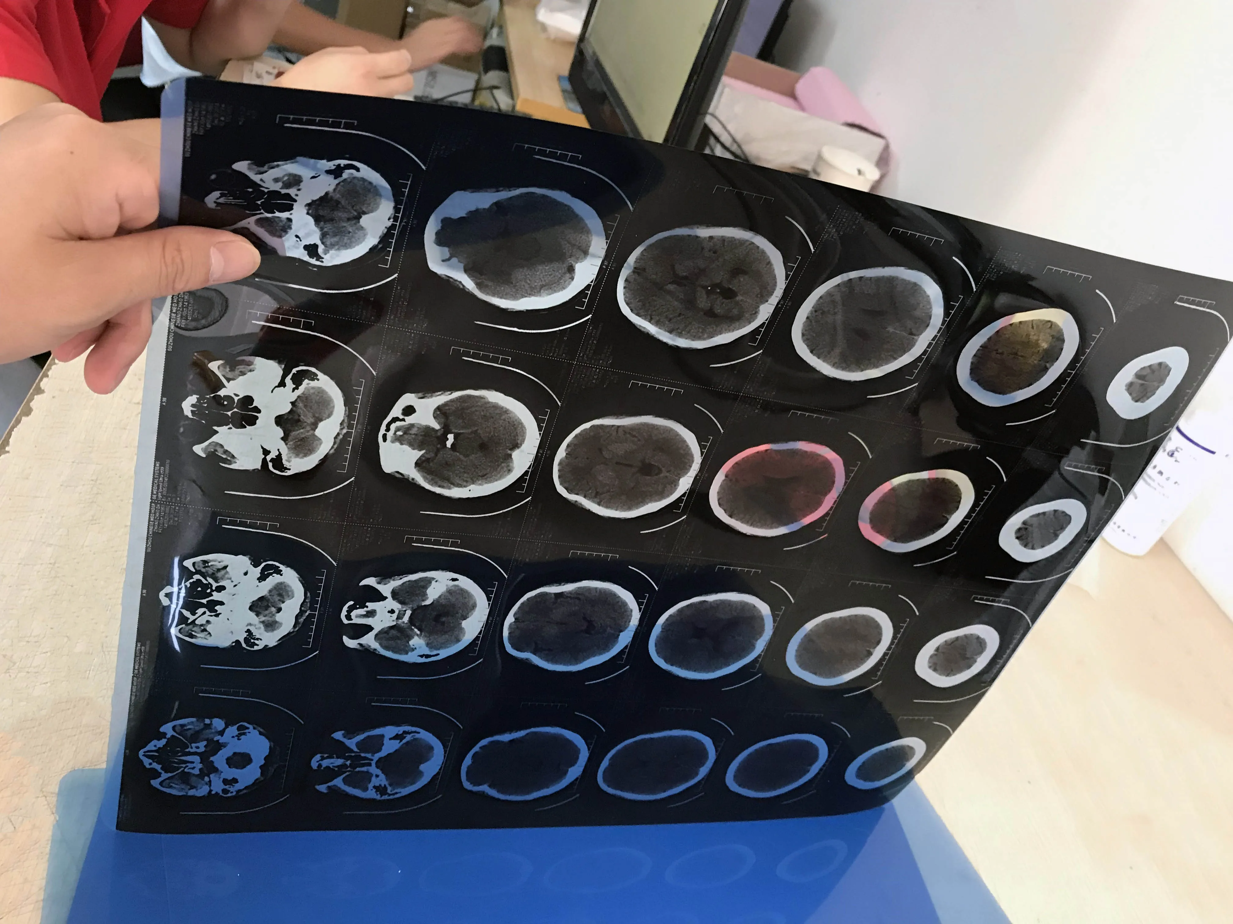 MSLZG4CAdjustable Medical LED X Ray Imaging Film Viewer Quadruple View Box