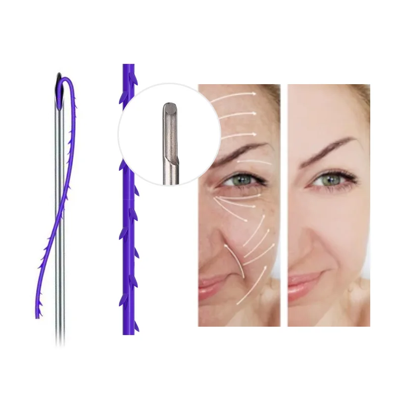 Pdo 2023 Advanced Sharp Needle Face Lift Thread Cog 3D Multiple styles available for deep wrinkle reduction