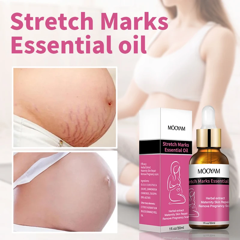 Private label OEM ODM reduce anti pregnancy stretch Pregnant belly stretch marks removal Pregnancy mark oil