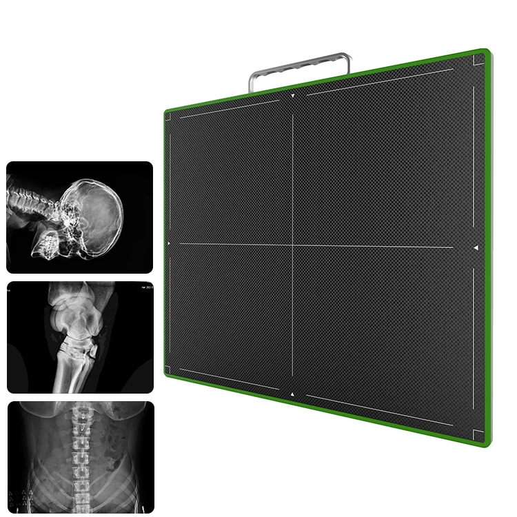 MSL Professional High Resolution X-Ray Flat Panel Wireless Careray Flat Panel Detector Veterinary