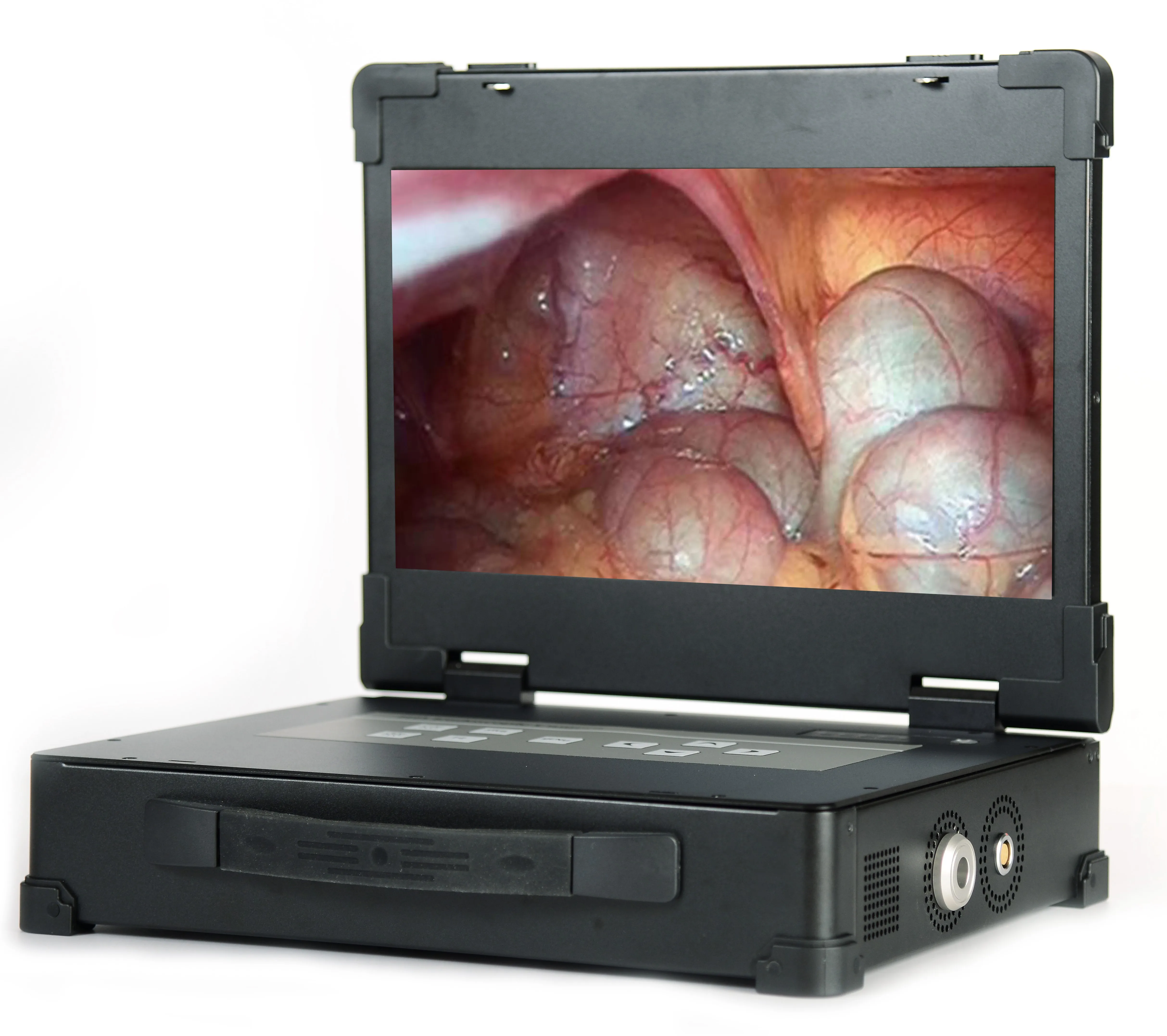 Surgical Instruments Basis Medical Endoscopy Camera System with Light SourceSIN-SED10