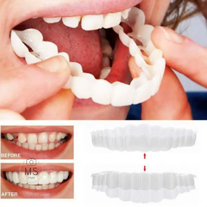 Popular Snap smile customized Perfect Smile teeth Upper lower False teeth cover Denture socket on sale