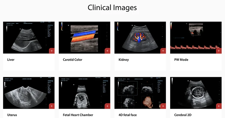 2023 Mindray DC-30 Ultrasound System 3D 4D Trolley Color Doppler Machine With 21.5 Inches Full HD LED Monitor