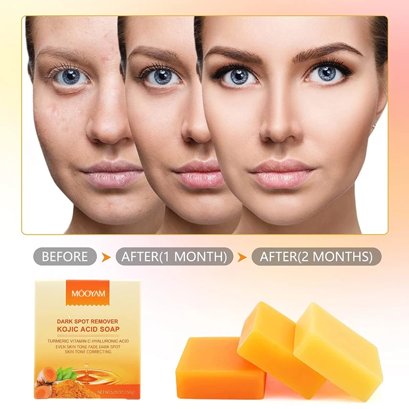 2023 Factory Price Original Whitening Skin Care Raw Material Kojic Acid Original Soap Tightening Detox Soap