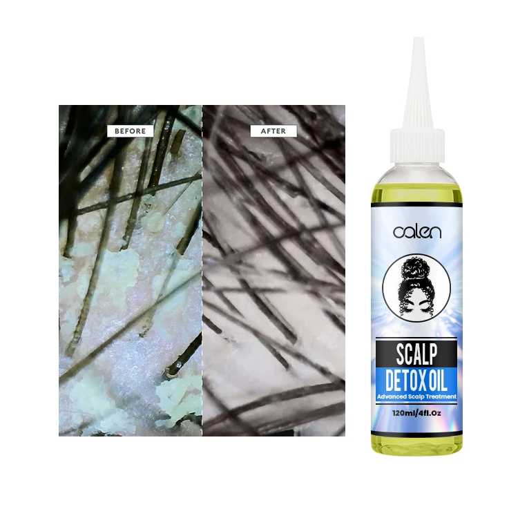 Luxfume OEM 250Ml Herbal Product Treatments Scalp Cleansing Scalp Care Detox Scalp Oil