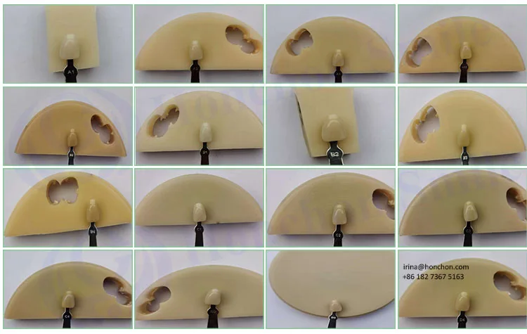 98MM Dental PMMA Block and Flexible Acetal Disc for Dental Labs | CAD CAM Milling Multilayer Dental Resin Block