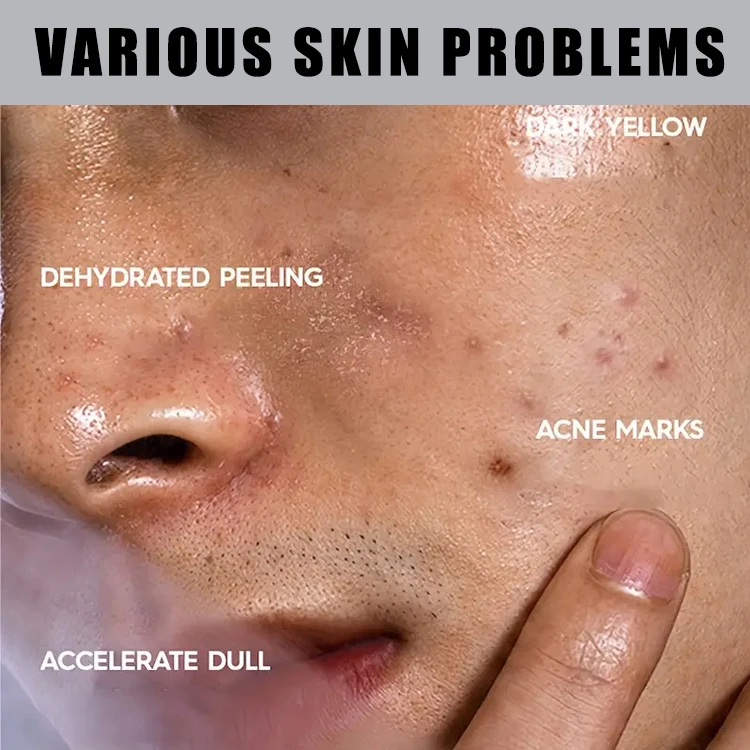 3 Minute Clay Mask Tea Tree & Eucalyptus Deep Cleansing Blackhead Pores Oil Control Reduce Acne smooth Skin Scrub Face Wash