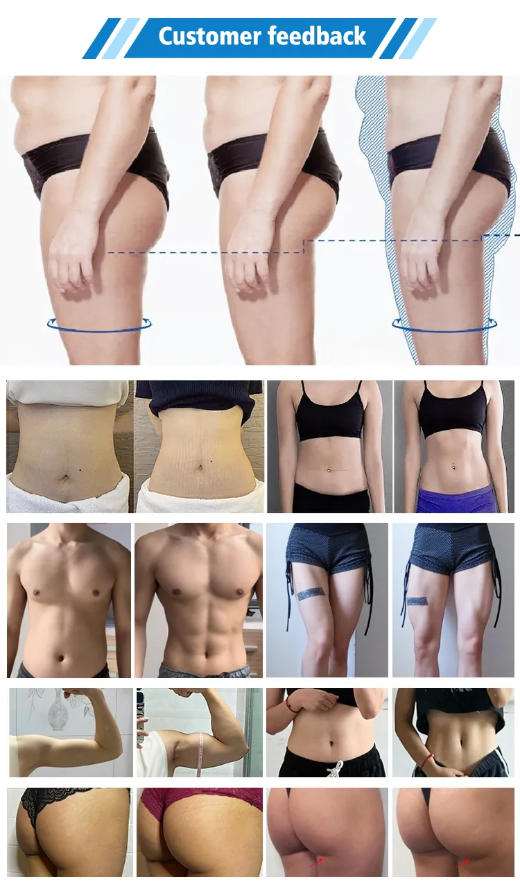 Muscle Building Weight Loss Ems Body Sculpt Machine Ems Slimming Skin Tightening Fat Burning Body Contouring Machine