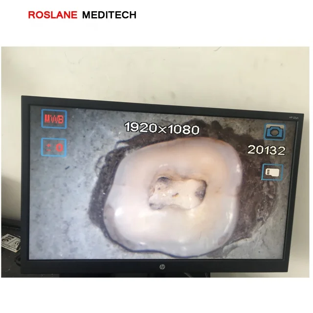 Company Supply Wholesale Price Dental Surgical Microscope for Sale