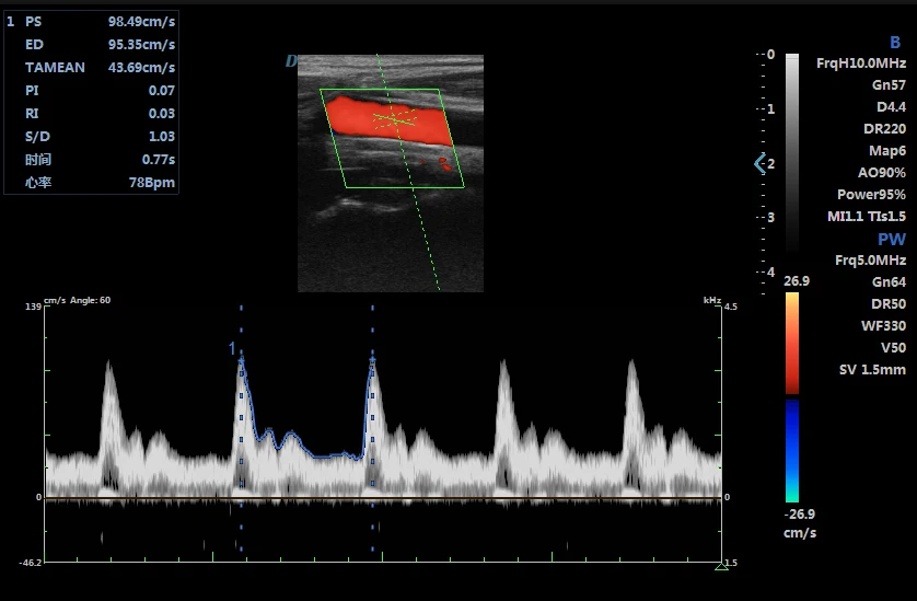 Dawei Tissue Doppler Imaging THI TDI Veterinary Color Doppler Ultrasonic System