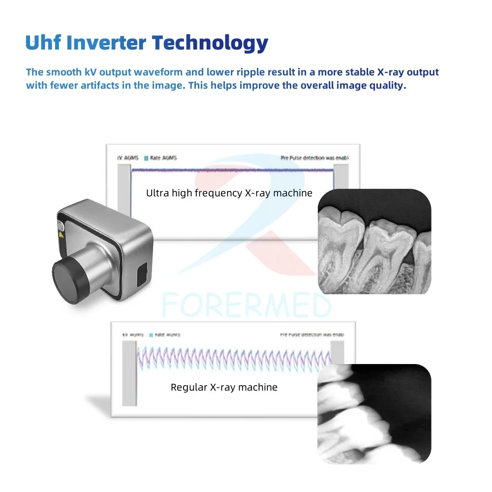 Portable Dental X-rays Machine Digital Hand held Dental X Ray Machine With Sensor Portable Dental X ray 5.6' Color Touch Screen