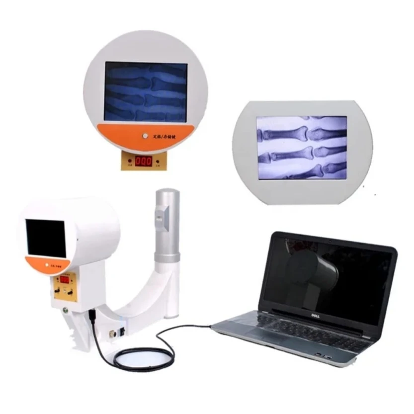X Ray Machine Portable/ C Design X-Ray Machine for X  Ray Diagnosis