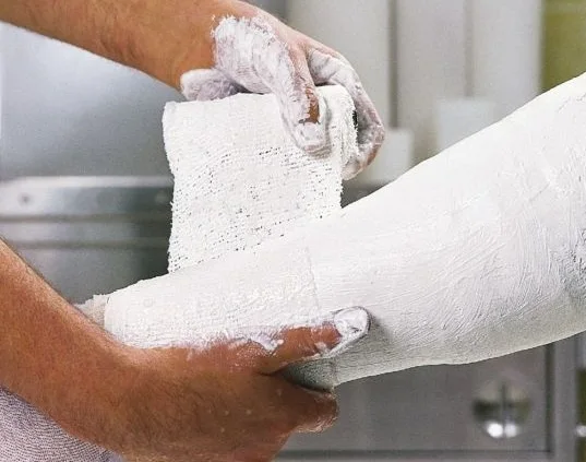 Medical grade 18 gypsum great quality plaster for medical purposes, wholesale FCA price per 1ton, quality dentistry gypsum