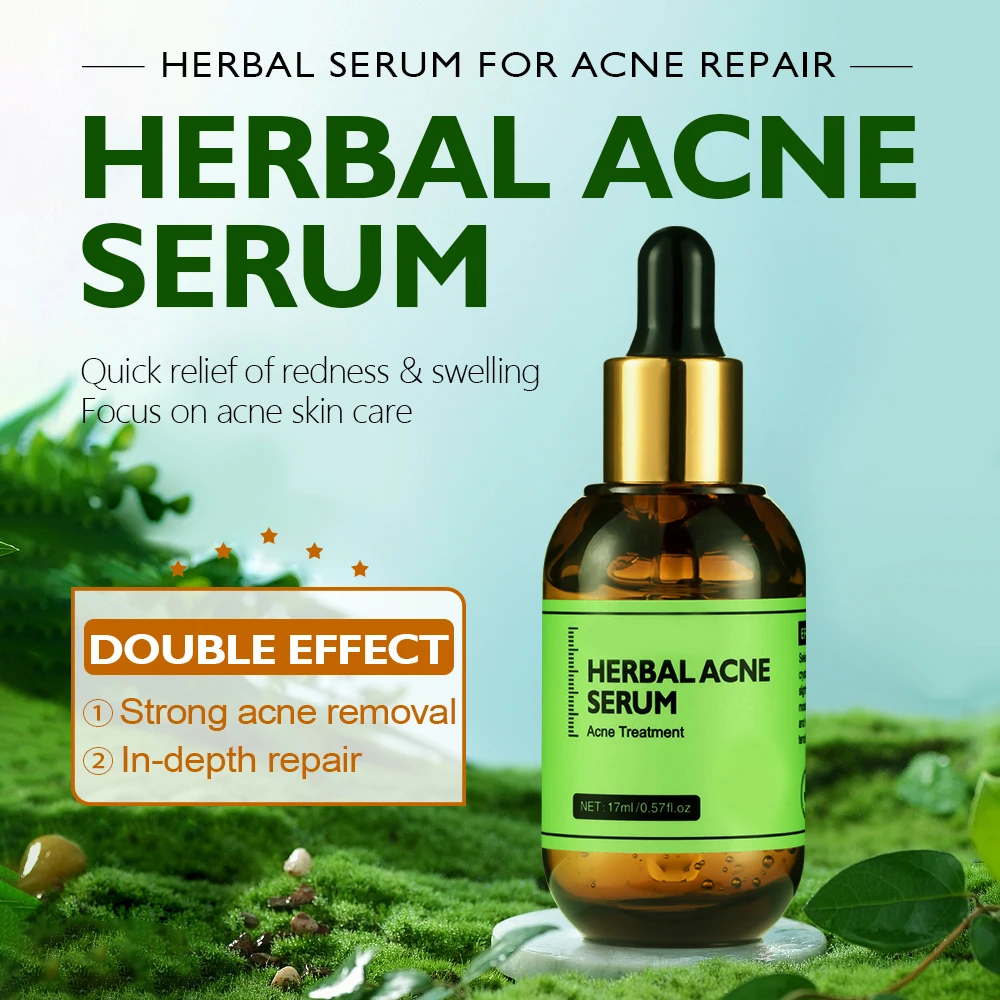 Acne Treatment Serum Private Label Acne Spot Serum Treatment Skin Care Acne Treatment Face Serum