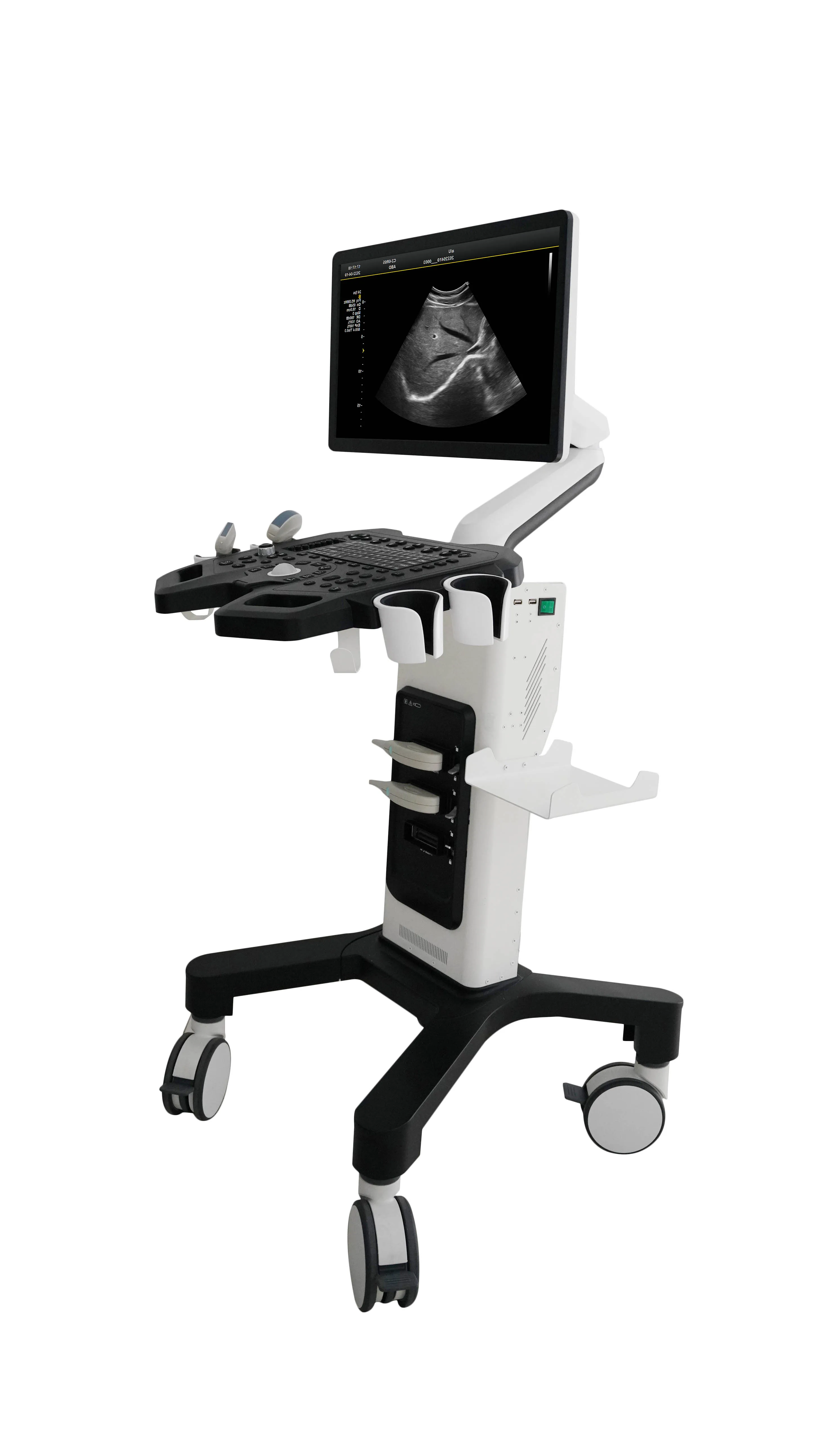 Cost-effective color doppler ultrasound trolley for hospital diagnostic examination with 2B/4B imaging MSLCU10.
