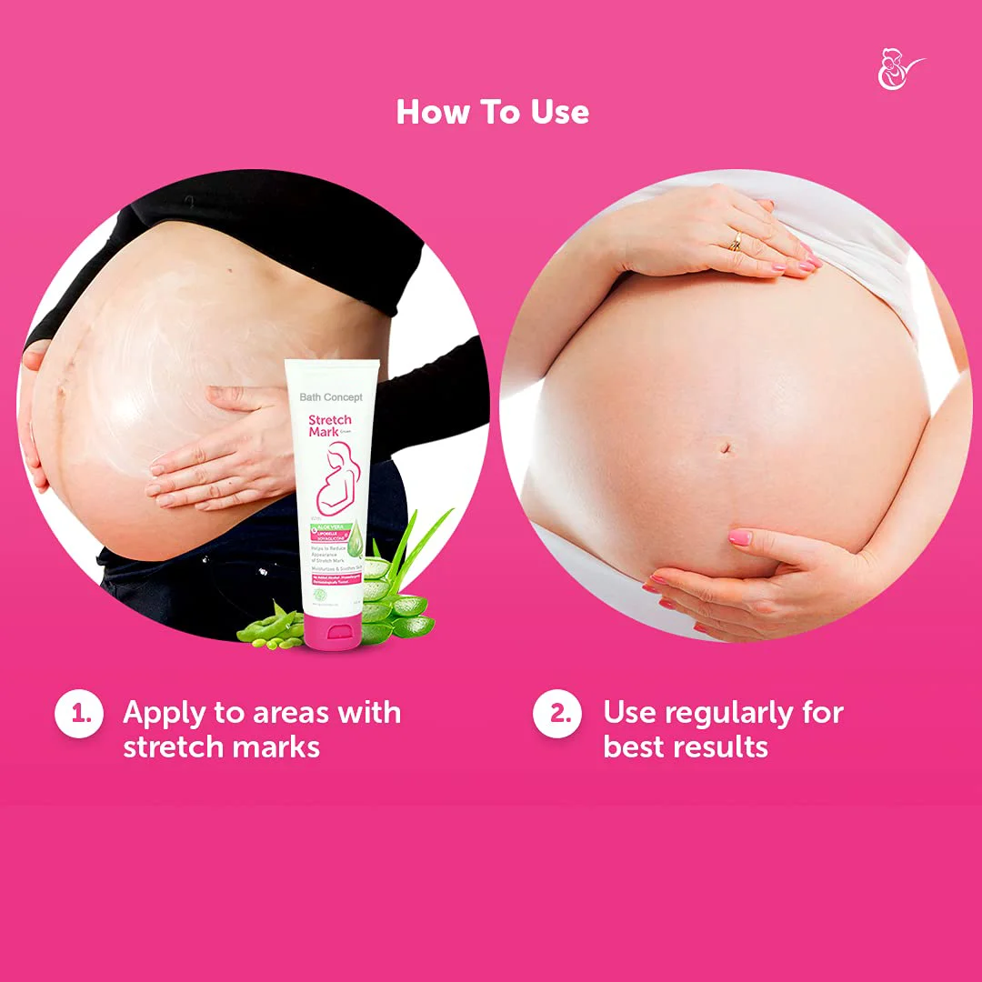 Private Label Repair Postpartum Scar Skin Firming Stretch Mark Removal Maternity Care Removal Stretch Mark Cream