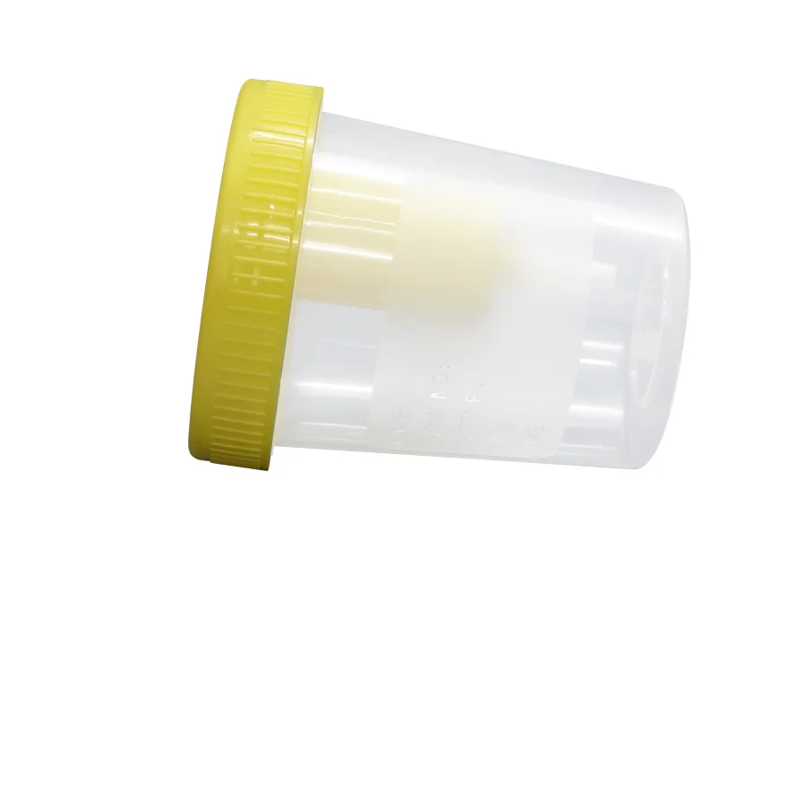 Vietnam plastic urine specimen collection with lid sterile OEM - delivery quickly free tariff- M0271