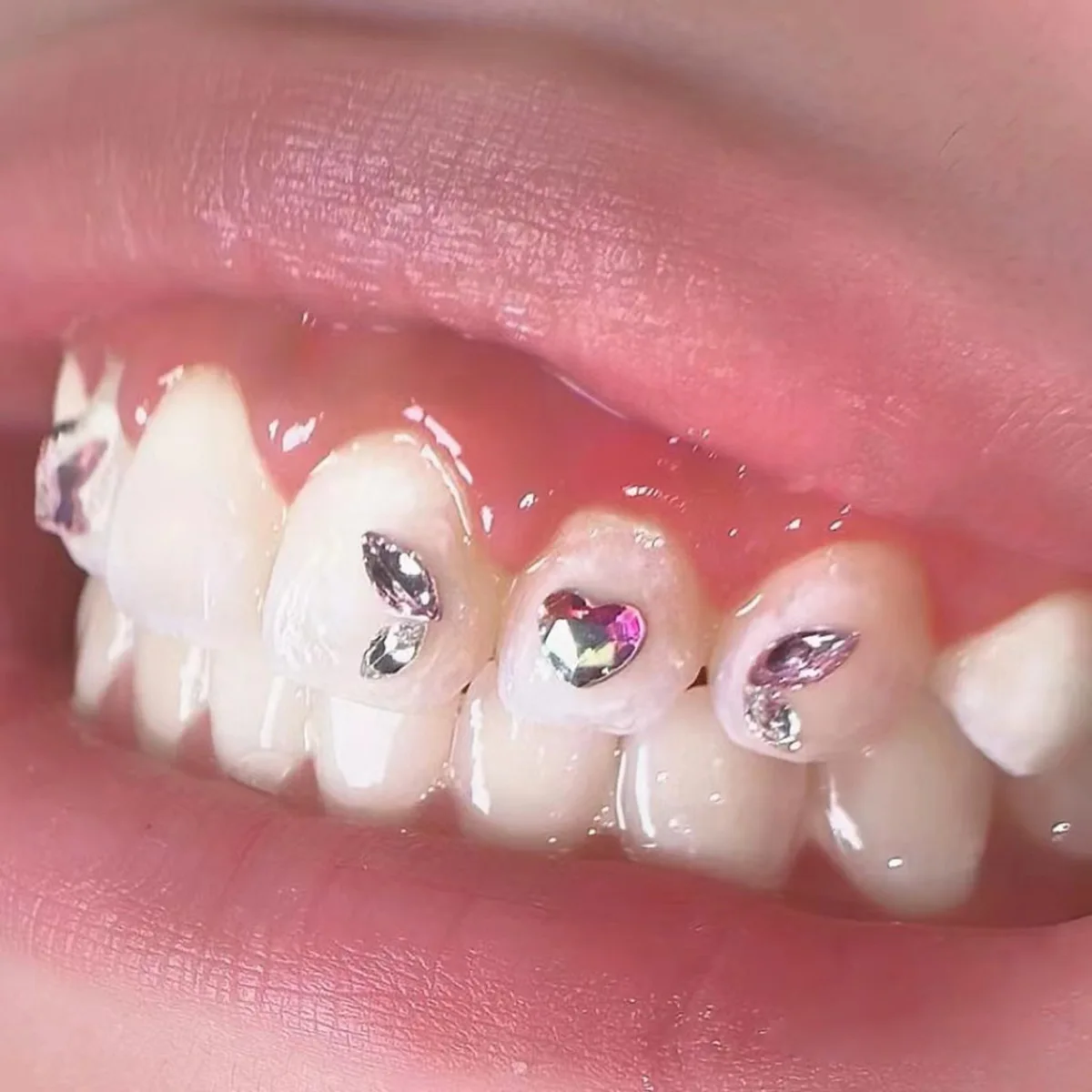 Dental Tooth Gems Crystal Diamond Ornament Various Shapes Color Teeth Jewelry Denture Acrylic Teeth Decoration Tooth Gem