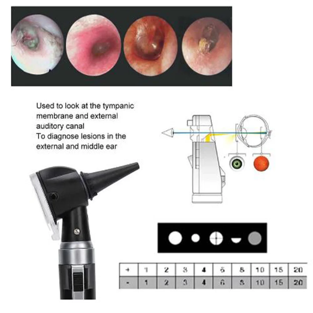 Fiber Optic Otoscope Examination LED Set Medical ENT Device for Accurate Ear and Ophthalmoscope Diagnostics