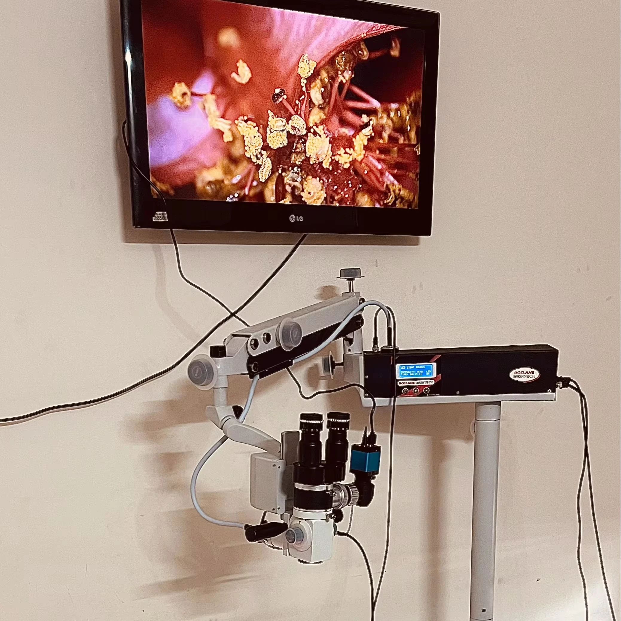 ROM-6 Professional ENT Operating Microscope for Microsurgery for Ear Operations and Procedures