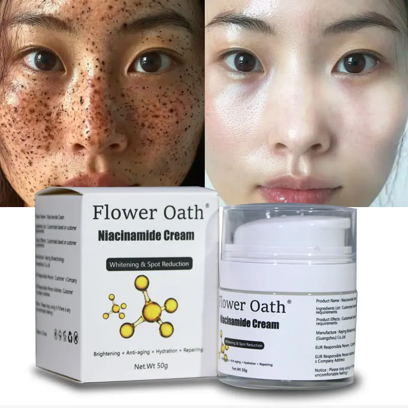 melasma blemish dark spot removing corrector,vitamin b3 niacinamide glowing face moisturizer,nicotinamide whitening face cream