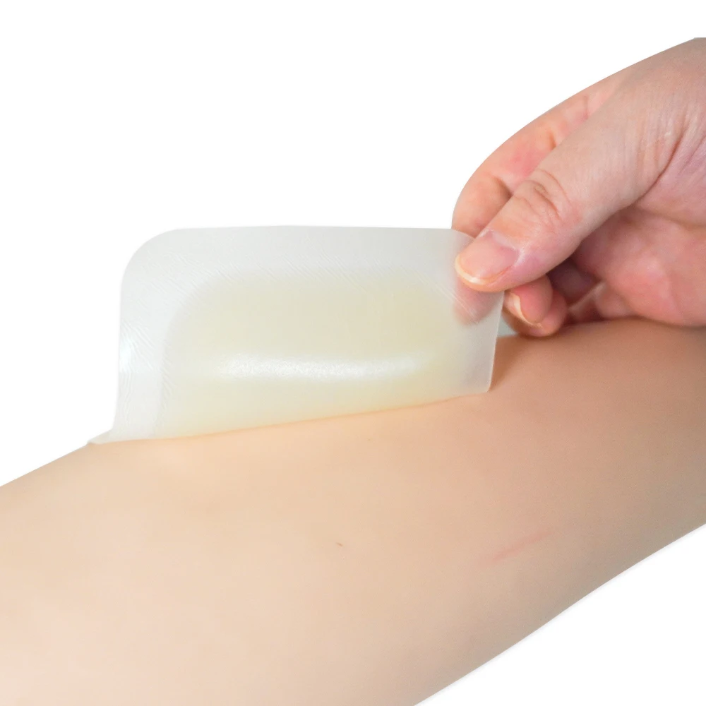 OEM Sticky Hydrocolloid Wound Dressing With Border For Pressure Sores Care Bedsore Nursing Ulcers Paste 10*10cm