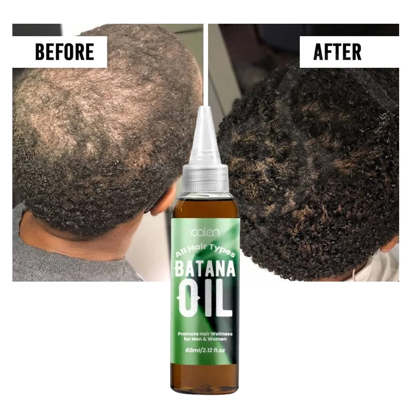Manufacturers OEM Batana Oil 60ML Anti Loss Hair Batana Hair Butter Organic Batana Oil For Hair Growth