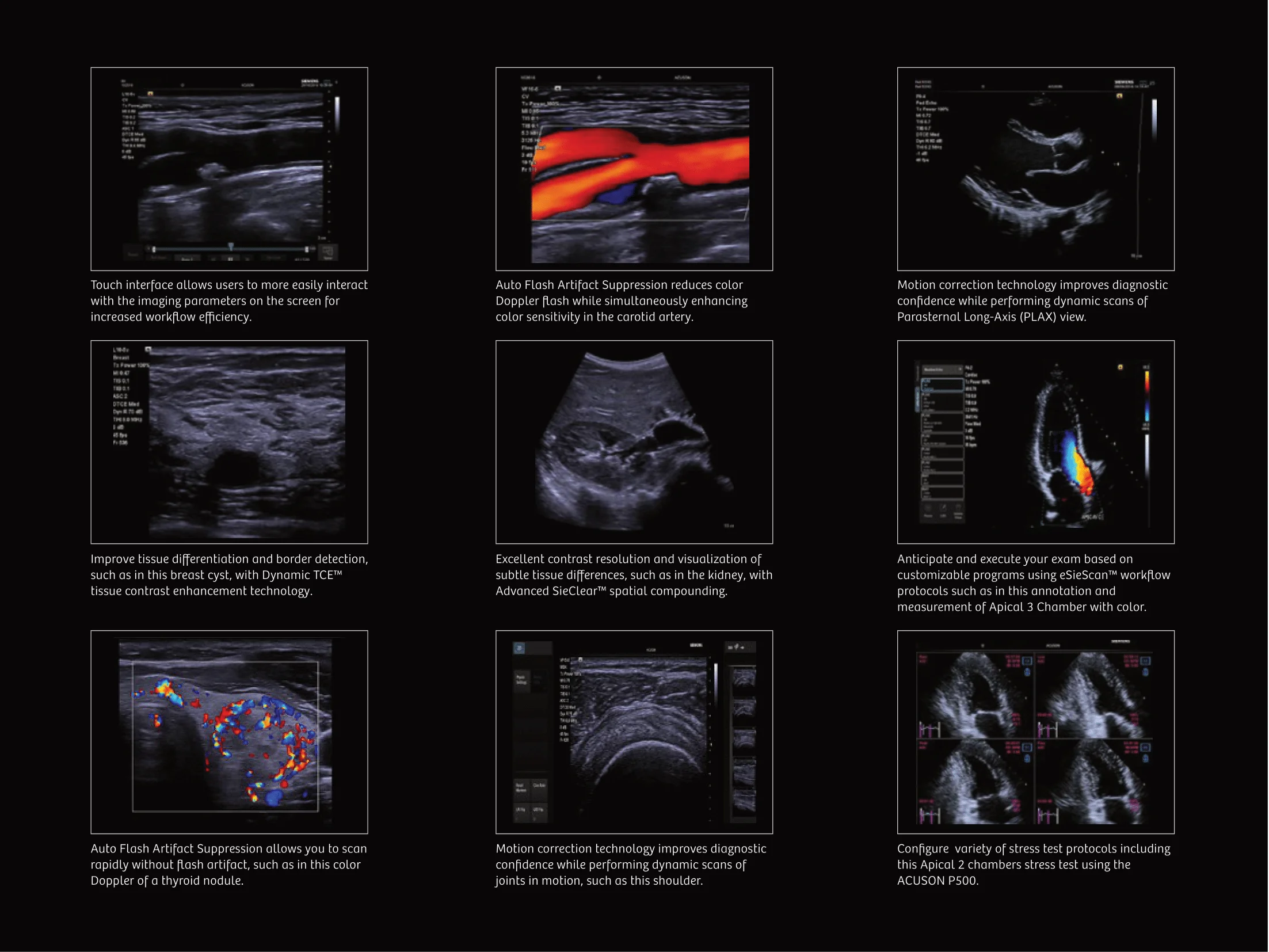 P500 Brochure-05.png